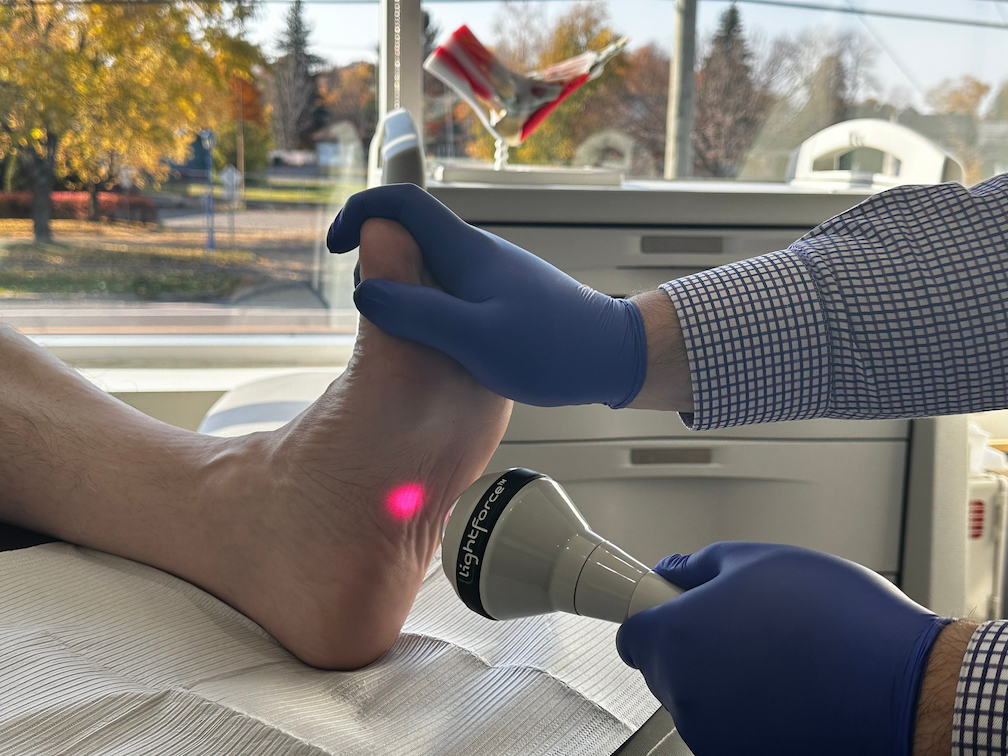 Podiatre qui fait du laser thérapeutique de la marque Litecure sur le talon d'un patient