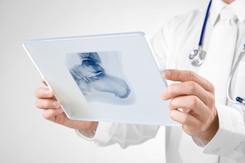 Podiatre regardant sur une tablette une radiographie d'un pied