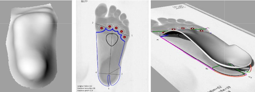 Reconstruction 3D d'un pied