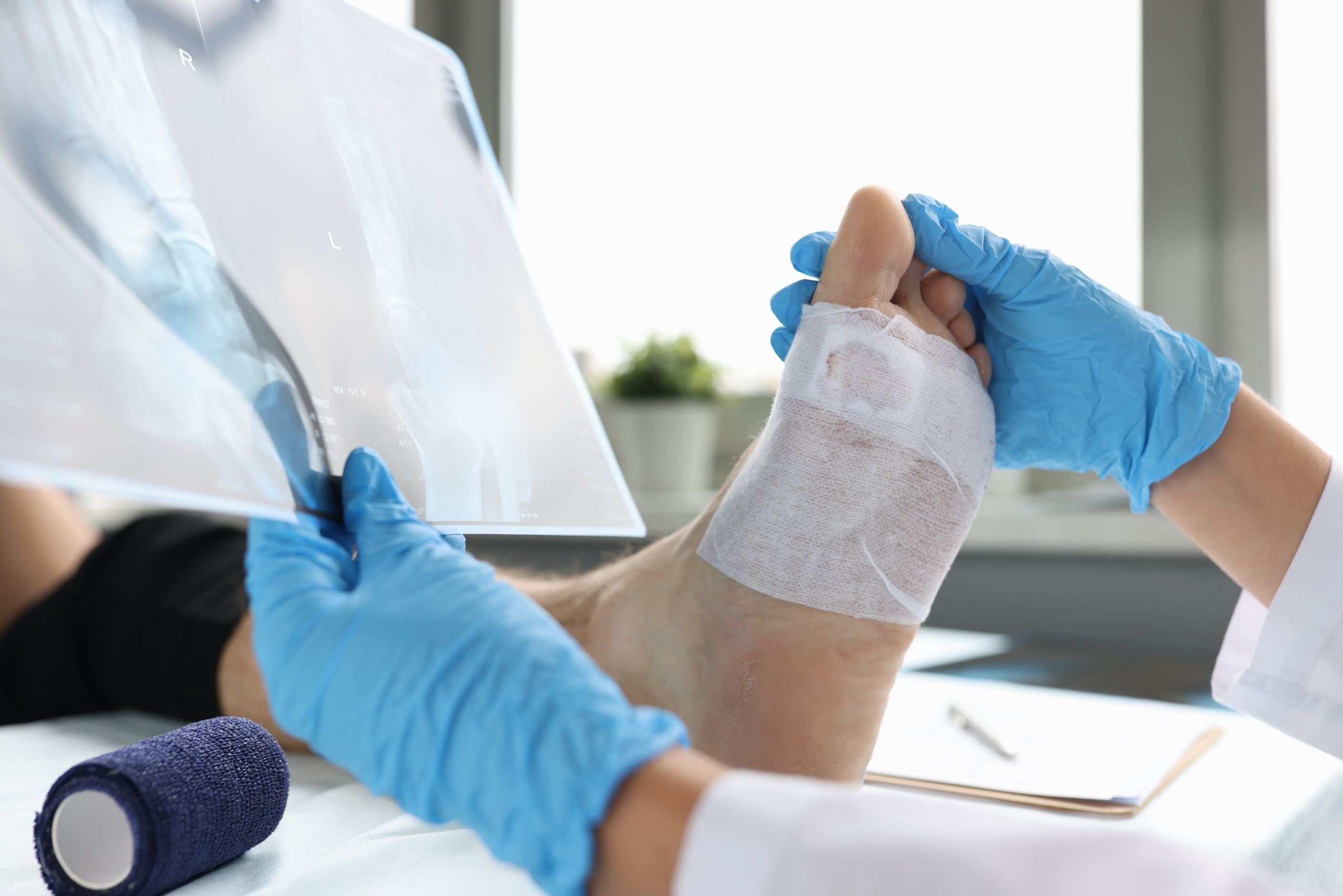 Podiatre qui tient une radiographie dans sa main tout en tenant le pied d'un patient qui a un pansement