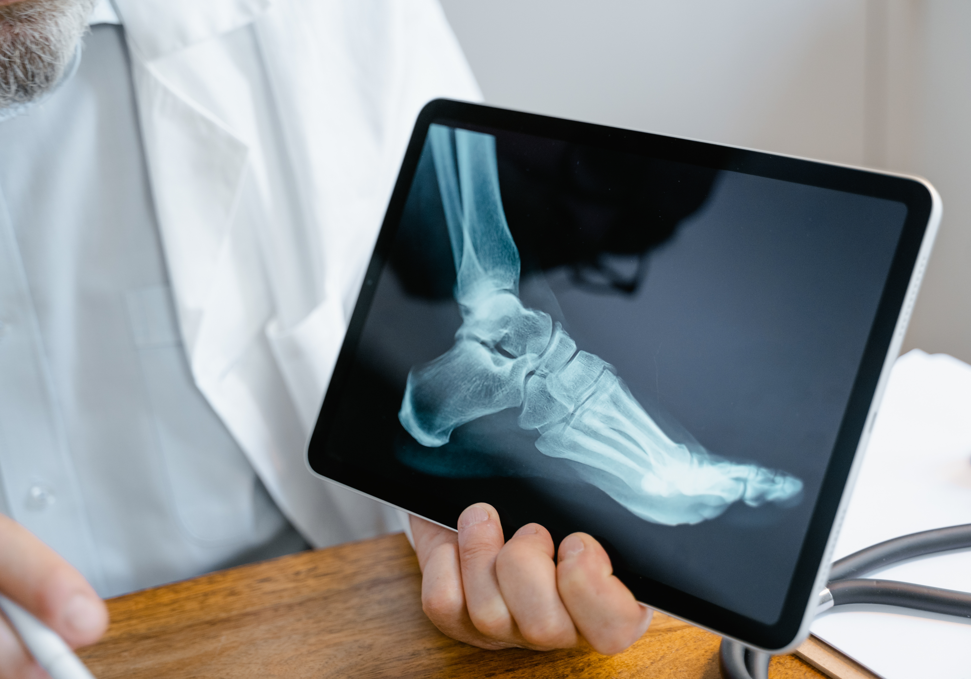 Radiographie d'un pied