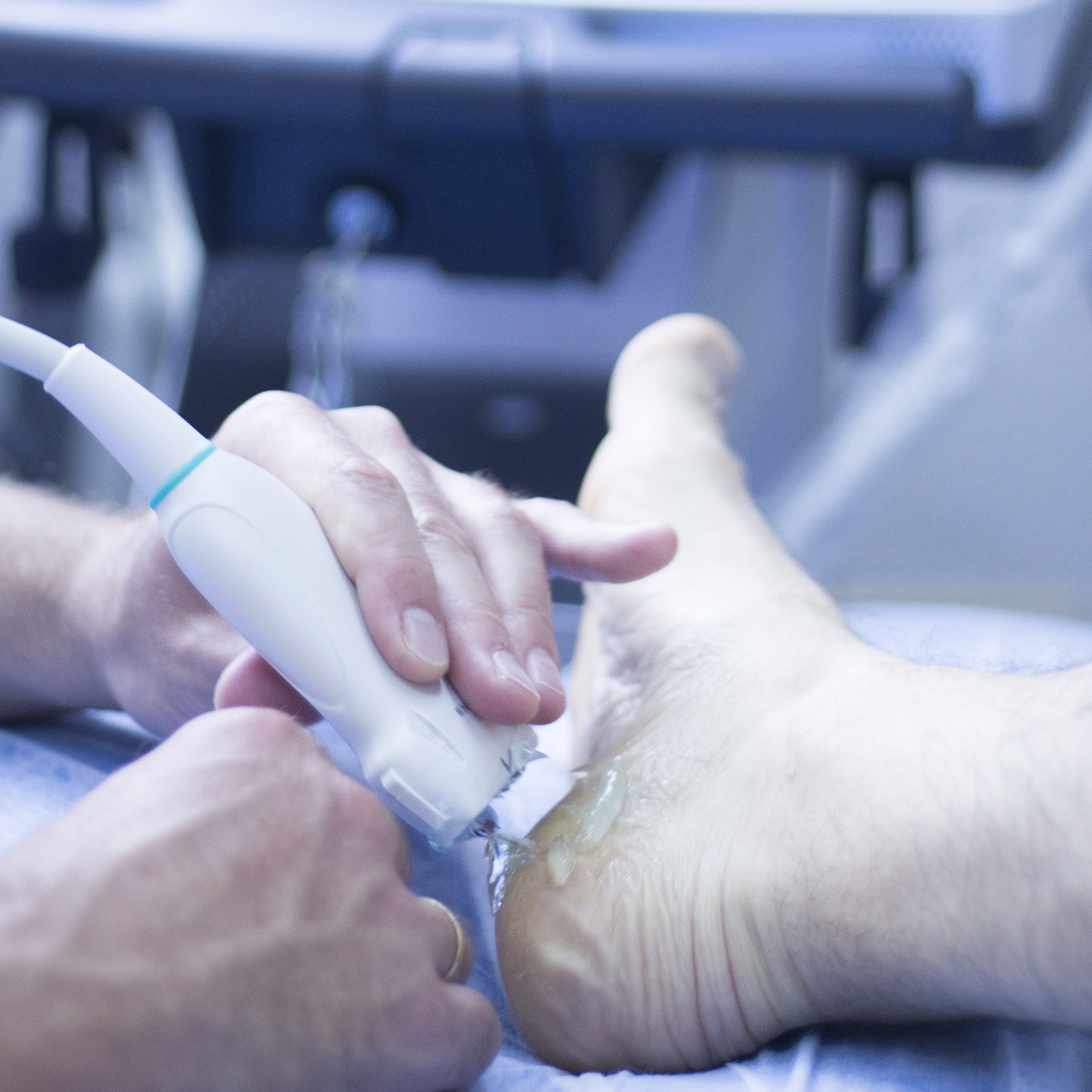 Échographie au talon